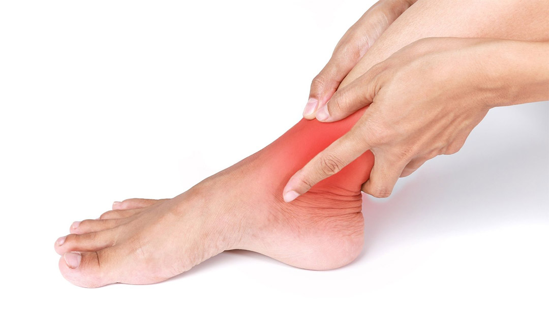 Esguince de tobillo. Síntomas, causas y consejos Centro Podológico Goitia