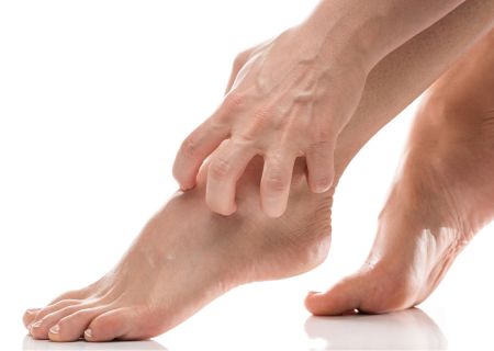 cómo combatir el picor en los pies